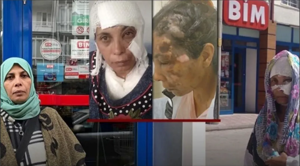 BİM’DEN ALDIĞI LAVABO AÇICISI YÜZÜNE PATLADI HAYATI KARARDI