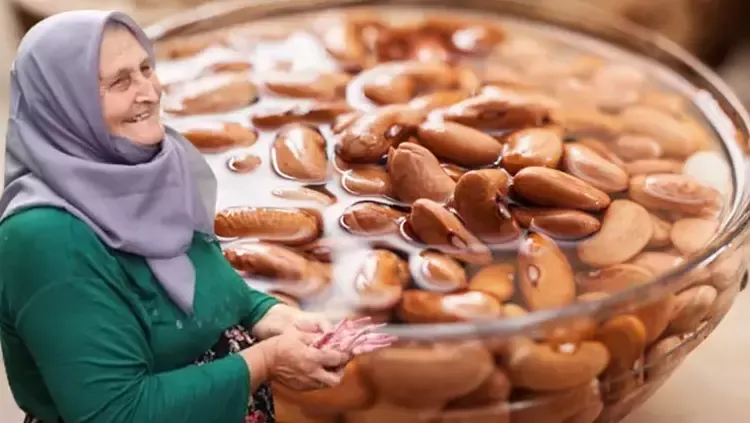 TÜRKİYE