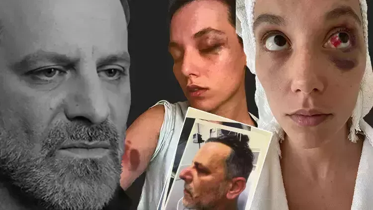 KADINA ŞİDDET.. OYUNCU OZAN GÜVEN