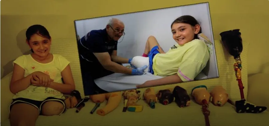 ARTIK DAHA RAHAT YÜRÜYECEK.. ANTALYA’DA ÖZGE PROTEZ BACAĞINA KAVUŞUYOR 